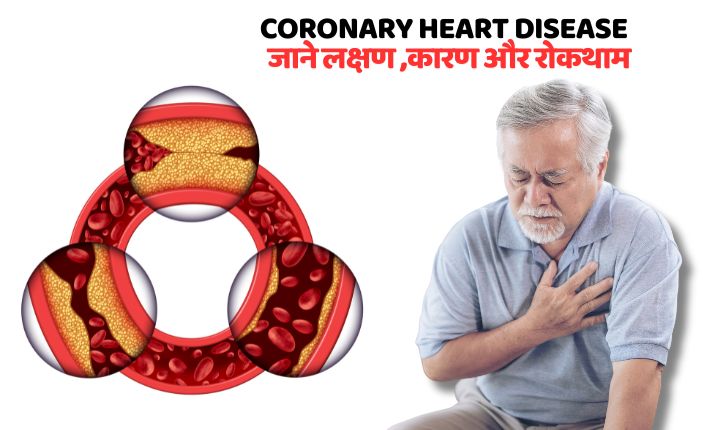 coronary heart disease जाने लक्षण ,कारण और रोकथाम